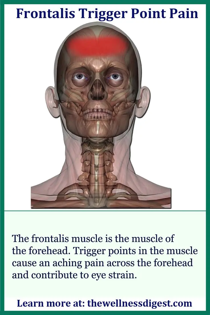 Forehead Pain Reasons